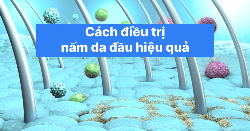 Cách trị nấm da đầu